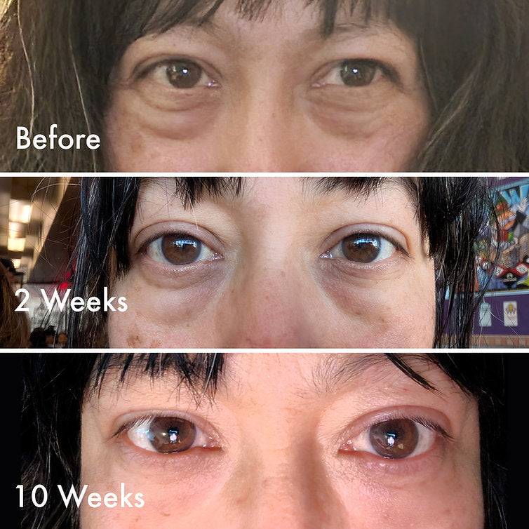 Lift and Lumen Under Eye Treatment